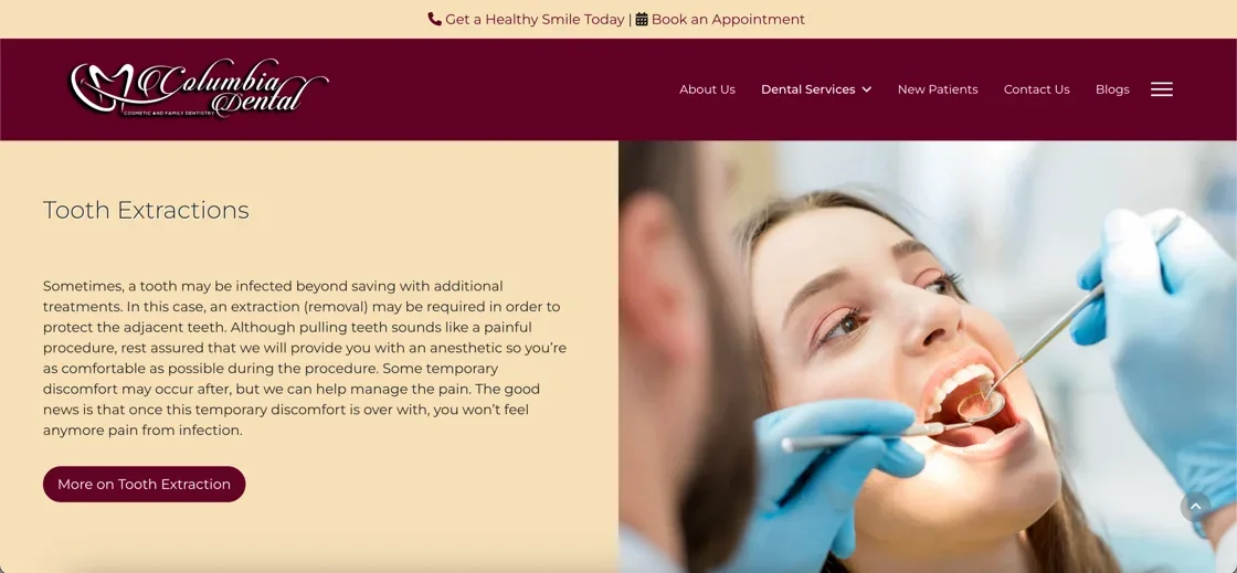 West Columbia Dental tooth extractions service page with treatment details